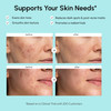 Maree Azelaic Acid Face Cream Azelaic Acid Treatment With Niacinamide and Salicylic