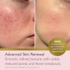 Revitale Advanced Salicylic Acid Cream For Face and Body Helps Smooth and 80G