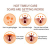Beauty Mall Crocodile Repair Serum Anti Scar Oil With Herbal Extract Activate Cell 15Ml 1Pc