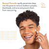Acnefree Terminator 10 Acne Spot Treatment With Benzoyl Peroxide 10% Maximum Strength 1 Ounce Pack Of 1