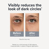 Loxadz Under Eye Brightener Roller Caffeine and Retinol Eye Serum For Dark 0.52 Fl Oz