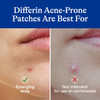 Differin Acne Treatment Pimple Patches, Salicylic Acid & Centella, 36 ct | Hydrocolloid Acne Spot Treatment, Salicylic Acid + Centella, Day & Night, Fast-Acting, Dermatologist Tested, Acne-Prone Skin