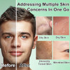 Gifts for Men,Skin Care for Men,Hydrating & Moisturizing Face Care Routine for Mens All Skin Types,Birthday Fathers Gifts Valentines for Him Dad Boyfriend Husband Christmas Stocking Stuffers