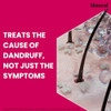 Nizoral Anti Dandruff Treatment Shampoo Treats and Prevents Dandruff Clinically Proven to Control Itchy and Flaky Scalps Contains Ketoconazole   60ml