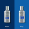 Nexxus Therappe Daily Shampoo Ultimate Moisture For Dry Hair Siliconefree 3 Oz 12 Pack