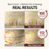 Goodal Black Carrot Vitaa Eye Cream With Retinol Daily Under Eye Cream Smoothing And Hydrating Skin Care Kbeauty Korean Skincare Safe For Sensitive Skin
