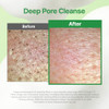 Makep:Rem Make Prem Pdrn Milk Essence Bubble Cleanser 145Mlmilk To Foam Daily Cleanser For All Skin Types Korean Face Wash 4.90 Fl.Oz.