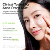 Anua Azelaic Acid Cica Skin Soothing Moisturizer Lightweight And Redness Relief For Acne Prone Skin Fragrance Korean Skincare 3.38 Fl Oz