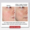 Thayers Rose Petal Facial Toner