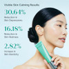 Rejuran Recover Firming Cream D.O.T Cpdrn Hydrolyzed Dna With Panthenol And Zinc Oxide Highadhesion Cream Texture For Elasticity Lifting And Soothing Care 50Ml