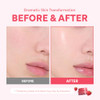 Hince Kingsberry Vita Night Cream Jelly Cream Dullness Improvement Niacinamide Face Moisturizer For Dry Skin Gives Hydration And Skin Overnight Korean Skincare 1.69 Fl.Oz