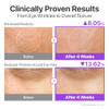 Numbuzin No.9 Nadplus Biolifting Duoessence plus Sheet Mask Set For Firming Wrinkles And Sagging Skin