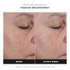 PaulaS Choice PaulaS Choice 25% Vitamin C Serum With Glutathione And Antioxidants Face Serum Improves Discoloration Uneven Tone And Firms All Skin Types Fragrancefree 1Oz