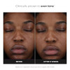 PaulaS Choice PaulaS Choice 25% Vitamin C Serum With Glutathione And Antioxidants Face Serum Improves Discoloration Uneven Tone And Firms All Skin Types Fragrancefree 1Oz