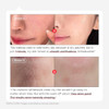 Parnell Aha 9.12% Omija Washoff Serum1Minute Face Exfoliation For Sebum Control And Smooth Texturepha Bha Lha Vitamin C Kcare 1.01 Fl Oz