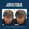 Nutrafol Men 50+ Hair Growth Supplements, Age 50+, 1-Month Pouch | #1 Dermatologist-Recommended Hair Growth Supplement Brand, Clinically Tested for Visibly Thicker Hair and Scalp Coverage