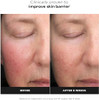 Paula's Choice  Mandelic  Lactic Acid Liquid Exfoliant  Gentle AHA Exfoliation for Discoloration Bumpy Texture andRadiance for Sensitive Skin Fragrance-Free