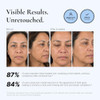 EnaSkin Dark Spot Corrector and  Remover Serum for Face and Body Niacinamide  A gentle acid free peptide formula helps fade stubborn discoloration and even out uneven skin tone over time