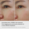 REJURAN Ampoule Infused Lifting Mask, DOT™ c-PDRN® Hydrogel, 4 Count