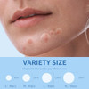 Daolyo Pimple Patches for Face Hydrocolloid Acne Patches