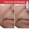 Erborian Ginseng Micro Shot Serum Microneedling Treatment Korean Skincare