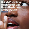Cetaphil Healing Ointment Soothes & Protects Dry Chapped Skin