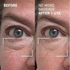 Dr. Brandt Skincare  Needles No More No More Baggage