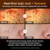 Dr.Melaxin Peel Shot Kojic Acid Turmeric Serum For Dark Spot Care Exfoliaing Dead Skin Korean Skin Care All Skin 80Ml