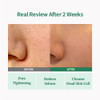 Sungboon Editor Firming Duo: Green Tomato Pore Peeling Jumbo Pad and Lifting Ampoule