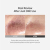 Sungboon Editor Blackhead Melting Clear Pad 65G30 Counts Blackhead Remover Pad Pore Minimizing Deep Cleansing and Pore Unclogging Clears Blackhaed Korean Skincare