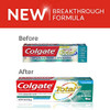 Colgate Total SF Toothpaste - Advanced Fresh + Whitening - Gel - Net Wt. 3.4 OZ (96 g) Per Tube - Pack of 4 Tubes