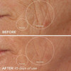 BeautyBio R45 | The Total Reversal Bundle