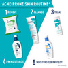 Acne prone skin routine