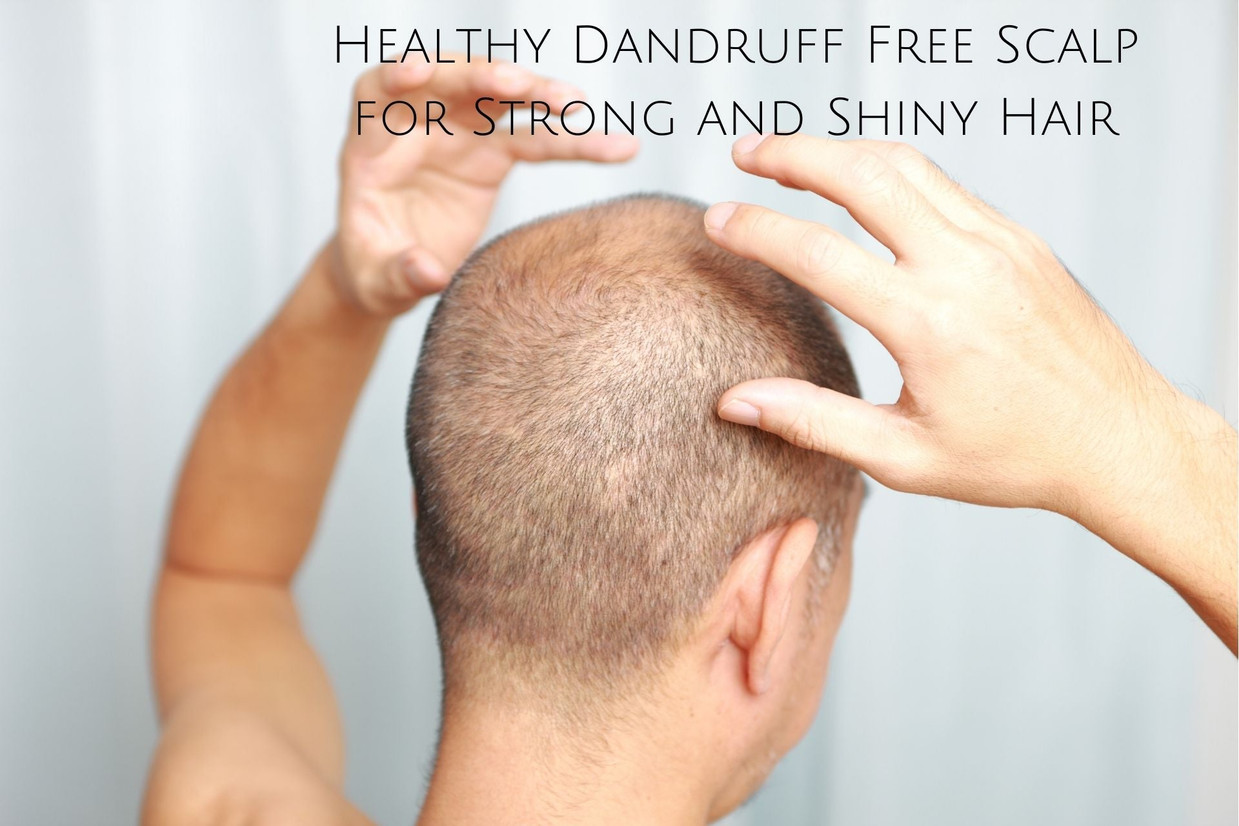 Healthy Dandruff Free Scalp for Strong and Shiny Hair Healthy Dandruff Free Scalp for Strong and Shiny Hair