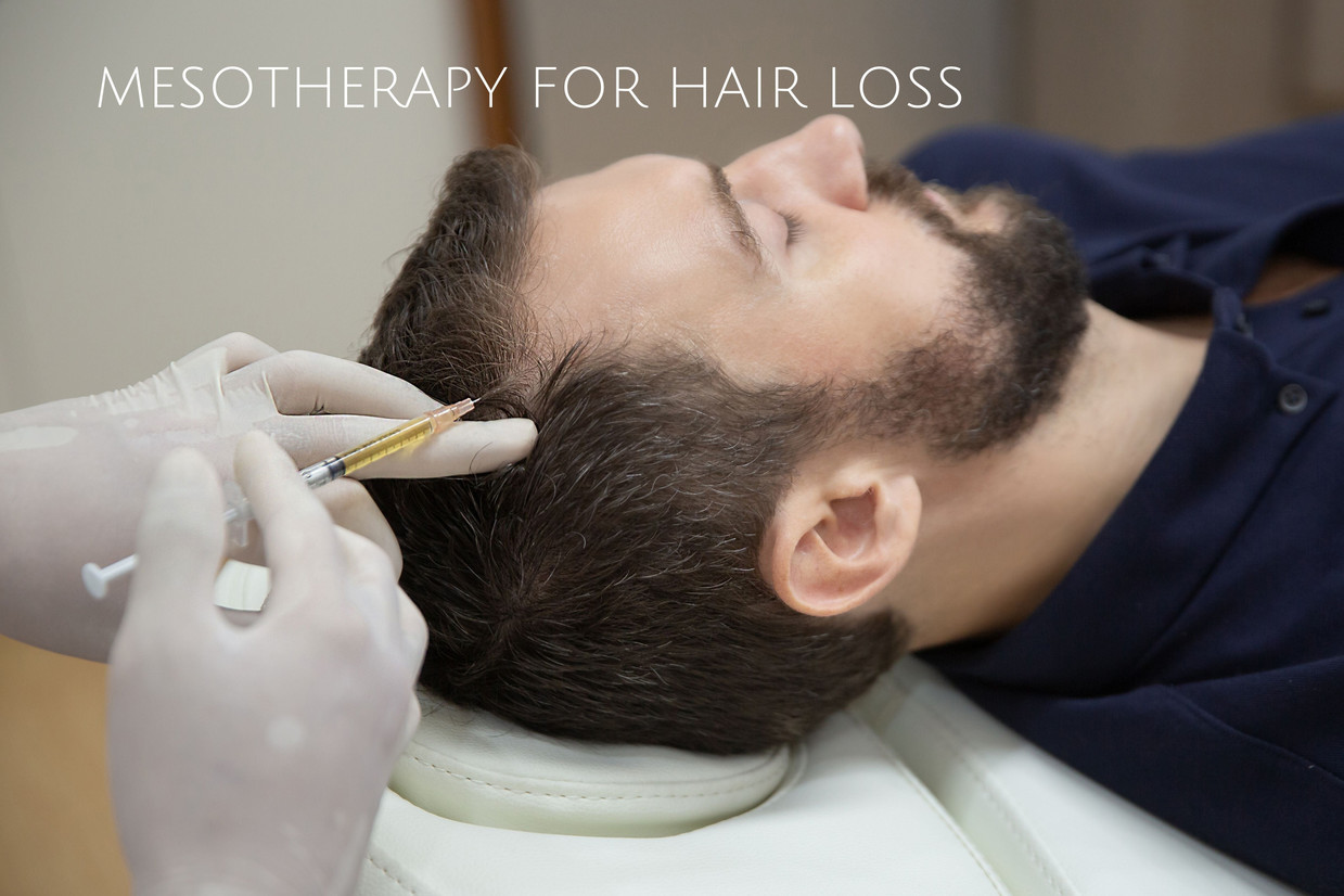 Mesotherapy for Hair Loss