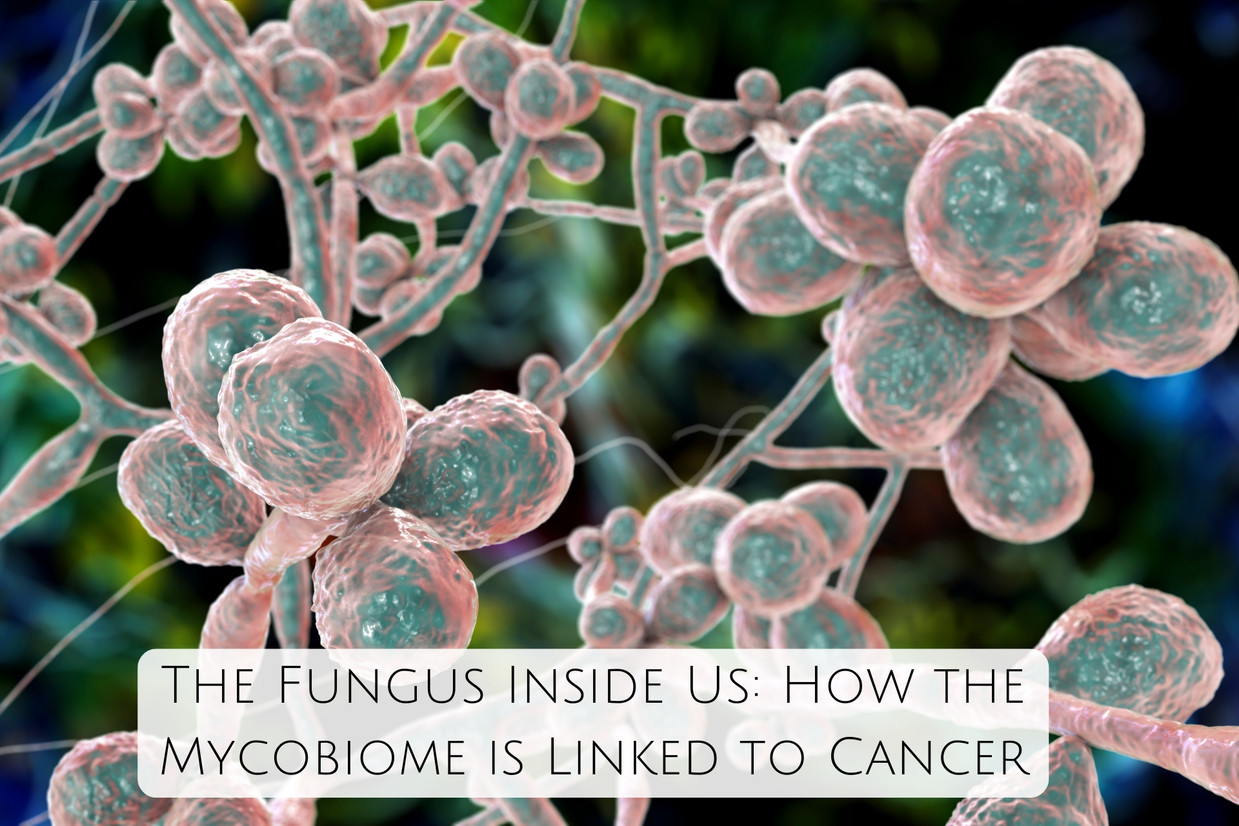 The Fungus Inside Us: How the Mycobiome is Linked to Cancer