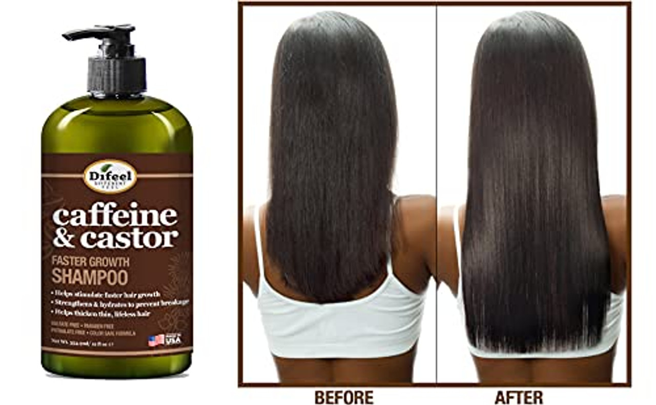 Buy Fantraa Castor Oil Shampoo 300 ml Online at Best Price  Shampoos