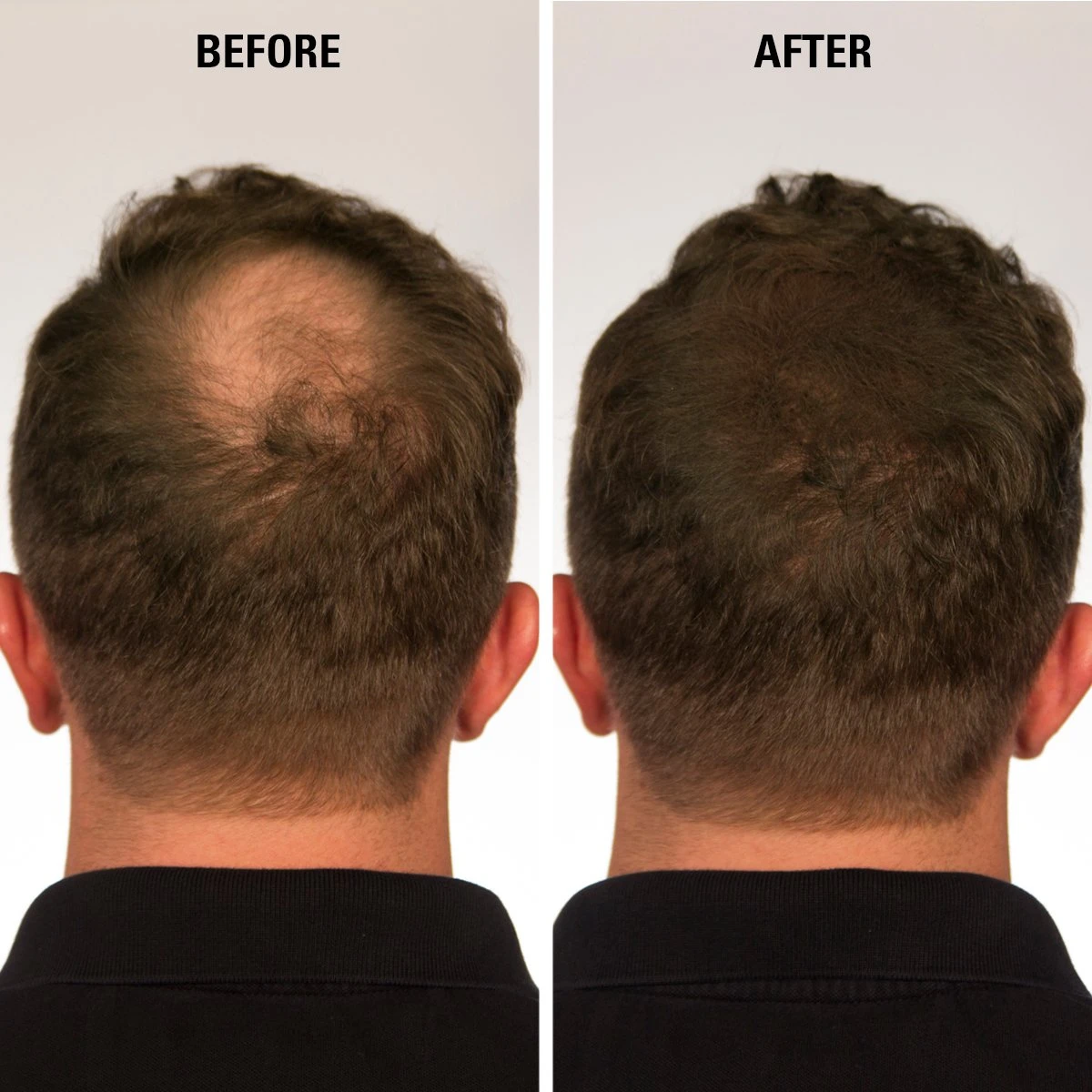 Men's hair before and after