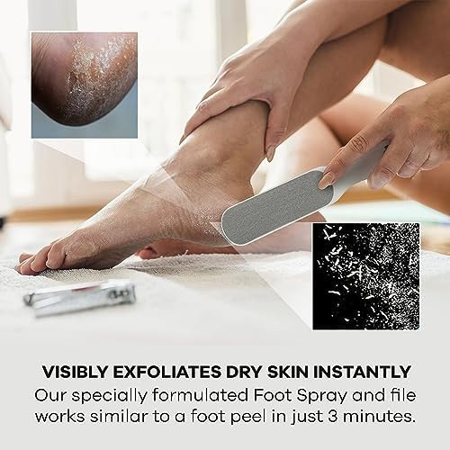 Callus Remover Soften Heels On Feet OEM Best Callus Remover