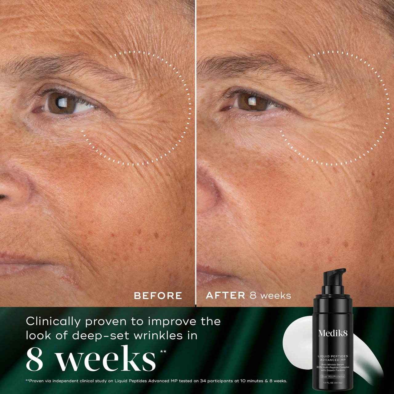 Medik8 Overnight Renewal Kit - Advanced Liquid Peptides Face Serum