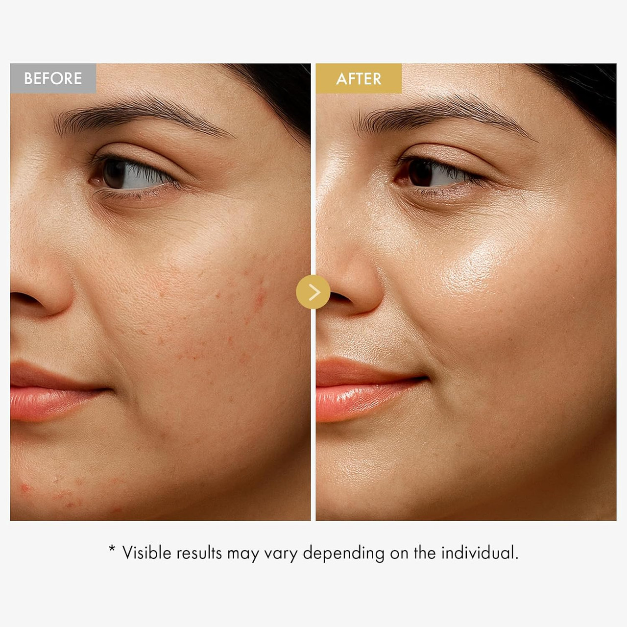 how much is glutathione injection in philippines Lanthome Glutathione Cream for Face 50 Gm Whitening Description  ➡【Brightening and regulating skin】The herbal extracts in the cream contain  a very high content of brightening active ingredients that help to quickly  remove main image 1