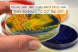 What Are Biofilms and Why Are They So Hard to Get Rid Of?