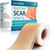 Silicone Scar Tape(1.6" × 120"Roll-3M), Medical Silicone Scar Sheets, Strips, Scars Away, Effective Professional Scar Removal Sheets For Keloids, Tummy Tuck, C-Section, Acne, Burn Et Silicone Scar Tape(1.6" × 120"Roll-3M), Medical Silicone Scar Sheets, Strips, Scars Away, Effective Professional Scar Removal Sheets For Keloids, Tummy Tuck, C-Section, Acne, Burn Et