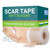 Medical Grade Silicone Scar Tape For Surgical Scars (1.6" X 120" - 3M) Professional Silicone Scar Sheets Scar Treatment For Face Wrinkles, C Section Recovery, Keloid Bump Removal Silicone Scar Patches Medical Grade Silicone Scar Tape For Surgical Scars (1.6" X 120" - 3M) Professional Silicone Scar Sheets Scar Treatment For Face Wrinkles, C Section Recovery, Keloid Bump Removal Silicone Scar Patches