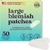 Livaclean 50Ct Large Pimple Patches For Face Nose Spots Pores - Xl Blemish Patches Acne Patch For Chin Forehead Body - Hydrocolloid Bandages For Acne - Big Clear Zit Stickers Large Hydrocolloid Patch Strips Livaclean 50Ct Large Pimple Patches For Face Nose Spots Pores - Xl Blemish Patches Acne Patch For Chin Forehead Body - Hydrocolloid Bandages For Acne - Big Clear Zit Stickers Large Hydrocolloid Patch Strips