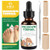 Smzhealing Ingrown Toenail Treatment: Ingrown Toenail Removal Kit - Ingrown Toenail Tool For Men Women - Ingrown Toenail Corrector Drops - Ingrown Toenail Remover - Effective Solution For Ingrown Toenails 30Ml Smzhealing Ingrown Toenail Treatment: Ingrown Toenail Removal Kit - Ingrown Toenail Tool For Men Women - Ingrown Toenail Corrector Drops - Ingrown Toenail Remover - Effective Solution For Ingrown Toenails 30Ml