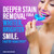 Gurunanda Premium Teeth Whitening Kit With Wired Led Light & Whitening Pen Works With Iphone & Android Helps Remove Surface Stains From Coffee Food Soda