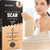 Tolevita Silicone Scar Patches Silicone Gel Sheets For Scars Acne Surgery Keloid Scar Removal And Stretch Marks Gentle Scar Care And Fading 5 Sheets Tolevita Silicone Scar Patches Silicone Gel Sheets For Scars Acne Surgery Keloid Scar Removal And Stretch Marks Gentle Scar Care And Fading 5 Sheets