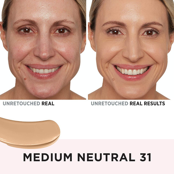 IT Cosmetics Your Skin But Better Foundation  Skincare Medium Neutral 31  Hydrating Coverage  Minimizes Pores  Imperfections Natural Radiant Finish  With Hyaluronic Acid  1.0 fl oz