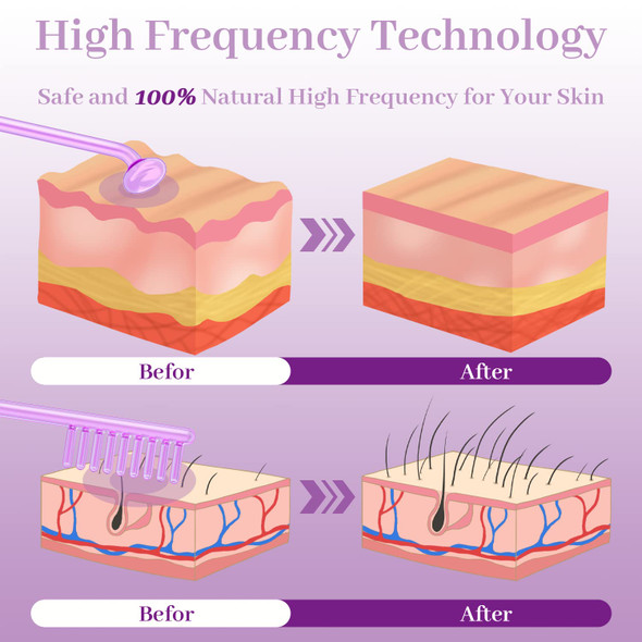 High Frequency Facial Wand - TUMAKOU Violet Portable Handheld High Frequency Facial Skin Machine Device for Face - with 4 Purple Tubes